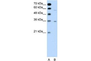 WB Suggested Anti-GPCR5A Antibody Titration:  0. (GPRC5A antibody  (C-Term))