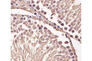 IHC analysis of FFPE mouse testis section using Cyclin B1 antibody; Ab was diluted at 1:25. (Cyclin B1 antibody  (AA 103-130))