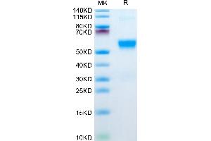 GP6 Protein (AA 21-267) (His tag)