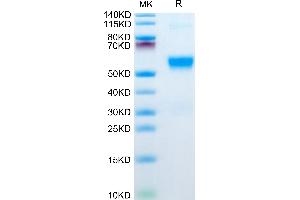 Human GPVI on Tris-Bis PAGE under reduced condition. (GP6 Protein (AA 21-267) (His tag))