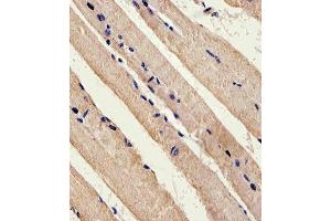 Immunohistochemical analysis of paraffin-embedded M. (LKB1 antibody  (C-Term))