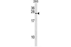 BOK Antibody (N-term) western blot analysis in 293 cell line lysates (35µg/lane).