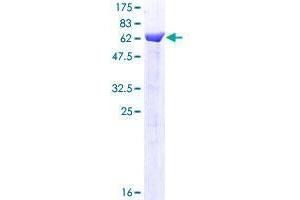 BRISC and BRCA1 A Complex Member 1 (BABAM1) (AA 1-329) protein (GST tag)