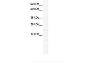 Image no. 1 for anti-Chromosome 16 Open Reading Frame 80 (C16orf80) (C-Term) antibody (ABIN6736001) (C16orf80 antibody  (C-Term))