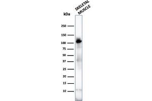 ACTN2 antibody  (AA 557-692)