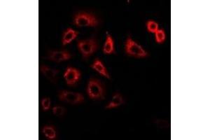 Immunofluorescent analysis of Tim17 staining in U2OS cells. (TIMM17A antibody)