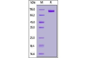 Fed Human NCAM-1, His Tag on  under reducing (R) condition. (CD56 Protein (AA 20-718) (His tag,FITC))
