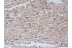 IHC-P analysis of Mouse Heart Tissue, with DAB staining. (BRD8 antibody  (AA 797-951))