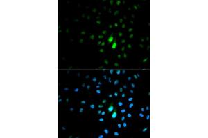Immunofluorescence analysis of MCF7 cell using PIN1 antibody. (PIN1 antibody  (AA 1-163))