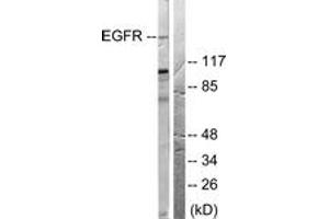 Western blot analysis of extracts from 293 cells, treated with EGF 200ng/ml 30', using EGFR (Ab-678) Antibody. (EGFR antibody  (AA 651-700))