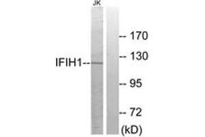Western Blotting (WB) image for anti-Interferon Induced with Helicase C Domain 1 (IFIH1) (AA 976-1025) antibody (ABIN2889746) (IFIH1 antibody  (AA 976-1025))