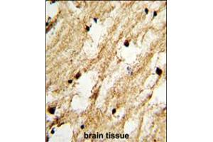 Formalin-fixed and paraffin-embedded human brain tissue with DCC1 Antibody (N-term), which was peroxidase-conjugated to the secondary antibody, followed by DAB staining.