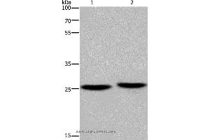 Western blot analysis of Mouse brain and human fetal muscle tissue, using EPDR1 Polyclonal Antibody at dilution of 1:850 (EPDR1 antibody)
