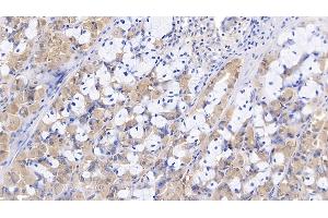 Detection of Slit3 in Porcine Stomach Tissue using Polyclonal Antibody to Slit Homolog 3 (Slit3) (SLIT3 antibody  (AA 1405-1512))