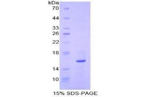 SDS-PAGE analysis of Human QSOX1 Protein.