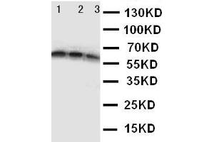 Anti-CD40 antibody, Western blotting Lane 1: Recombinant Human CD40 Protein 10ng Lane 2: Recombinant Human CD40 Protein 5ng Lane 3: Recombinant Human CD40 Protein 2.