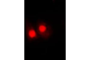 Immunofluorescent analysis of FANCA (pS1149) staining in HepG2 cells. (FANCA antibody  (C-Term, pSer1149))