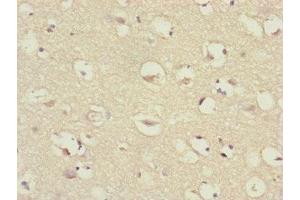 Immunohistochemistry of paraffin-embedded human brain tissue using ABIN7147409 at dilution of 1:100 (CEP57 antibody  (AA 1-240))