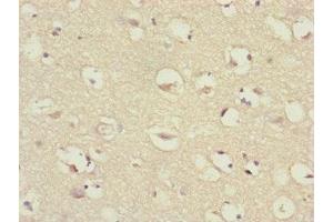 Immunohistochemistry of paraffin-embedded human brain tissue using ABIN7147409 at dilution of 1:100