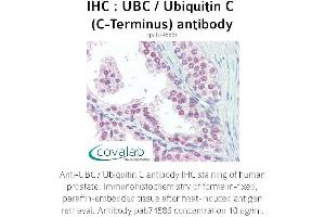 Image no. 1 for anti-Ubiquitin C (UBC) (C-Term) antibody (ABIN2852400) (UBC antibody  (C-Term))