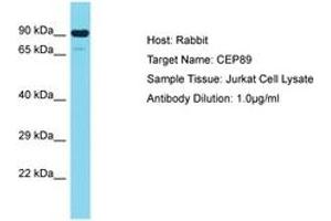 Image no. 1 for anti-Centrosomal Protein 89kDa (CEP89) (AA 41-90) antibody (ABIN6750706) (CEP89 antibody  (AA 41-90))