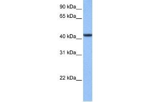 WB Suggested Anti-C8orf34 Antibody Titration: 0. (C8orf34 antibody  (N-Term))