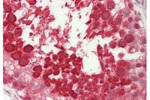 Rabbit Anti-Ubl5 antibody Catalog Number: ARP56285 Formalin Fixed Paraffin Embedded Tissue: Human Testis Primary antibody Concentration: 1:100 Secondary Antibody: Donkey anti-Rabbit-Cy3 Secondary Antibody Concentration: 1:200 Magnification: 20x Exposure Time: 0. (UBL5 antibody  (N-Term))