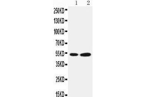 Anti-Selenium Binding Protein 1 antibody, Western blotting Lane 1: COLO320 Cell Lysate Lane 2: PANC Cell Lysate