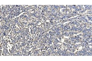 IHC analysis of HYI using anti-HYI antibody (ABIN7601796). (HYI antibody  (AA 46-277))