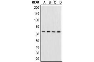 Western blot analysis of NF-kappaB p65 expression in HepG2 (A), MCF7 (B), Raw264. (NF-kB p65 antibody  (Center))