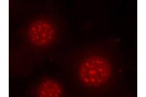 Immunofluorescence analysis of methanol-fixed MCF-7 cells using Phospho-FOXO4(S197) Polyclonal Antibody (FOXO4 antibody  (pSer197))
