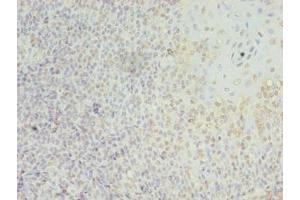 Immunohistochemistry of paraffin-embedded human tonsil tissue using ABIN7158252 at dilution of 1:100 (LILRA2 antibody  (AA 9-275))