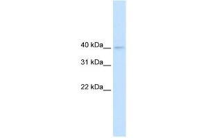 WB Suggested Anti-NUDT9 Antibody Titration:  0.