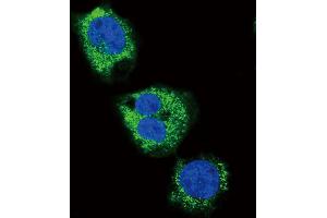 Confocal immunofluorescent analysis of FIBG Antibody (C-term) (ABIN390507 and ABIN2840862) with MDA-M cell followed by Alexa Fluor 488-conjugated goat anti-rabbit lgG (green). (FGG antibody  (C-Term))