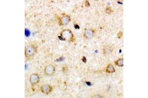 Immunohistochemical analysis of ANR52 staining in mouse brain formalin fixed paraffin embedded tissue section. (ANKRD52 antibody)