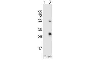 Western blot analysis of SPARC antibody and 293 cell lysate either nontransfected (Lane 1) or transiently transfected (2) with the SPARC gene.