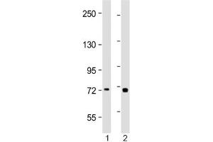 Western blot testing of human 1) placenta and 2) Jurkat lysate with TAP2 antibody at 1:2000. (TAP2 antibody  (AA 100-134))