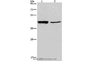 Western blot analysis of Human hepatocellular carcinoma tissue and A549 cell, using GRPR Polyclonal Antibody at dilution of 1:300 (GRPR antibody)