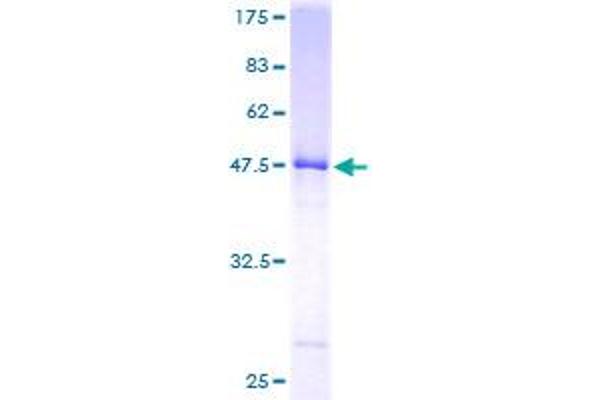 UBE2E2 Protein (AA 1-201) (GST tag)