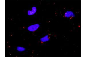 Proximity Ligation Analysis of protein-protein interactions between BIRC2 and CASP9.