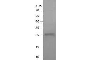 Western Blotting (WB) image for Layilin (LAYN) (AA 23-228) protein (His tag) (ABIN7283528) (Layilin Protein (LAYN) (AA 23-228) (His tag))