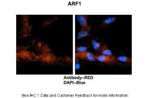 Immunohistochemistry (IHC) image for anti-ADP-Ribosylation Factor 1 (ARF1) (Middle Region) antibody (ABIN2783267)