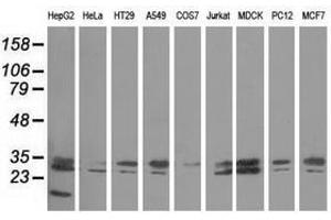 Image no. 2 for anti-Peroxisomal Trans-2-Enoyl-CoA Reductase (PECR) antibody (ABIN1500148) (PECR antibody)
