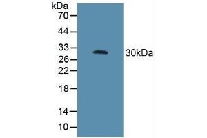 Figure. (FCGR3A antibody  (AA 26-108))