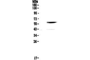 Western blot analysis of Cannabinoid Receptor I using anti-Cannabinoid Receptor I antibody . (CNR1 antibody  (AA 1-75))