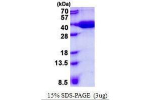 Figure annotation denotes ug of protein loaded and % gel used. (MPST Protein)
