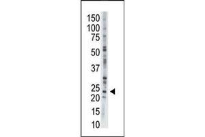 Image no. 1 for anti-Adenylate Kinase 1 (AK1) (C-Term) antibody (ABIN360679) (Adenylate Kinase 1 antibody  (C-Term))