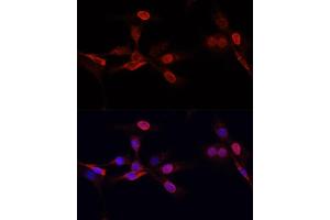 Immunofluorescence analysis of NIH/3T3 cells using TriMethyl-Histone H3-K27 antibody (ABIN7267698) at dilution of 1:25. (Histone 3 antibody  (H3K27me3))