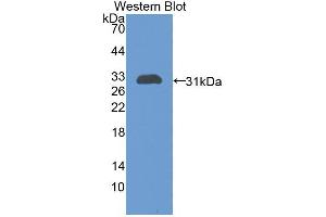 Western blot analysis of the recombinant protein. (CHI3L1 antibody  (AA 117-364))