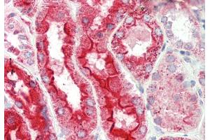 Rabbit Anti-Lrp2bp antibody  Formalin Fixed Paraffin Embedded Tissue: Human Kidney Primary antibody Concentration: 1:100 Secondary Antibody: Donkey anti-Rabbit-Cy3 Secondary Antibody Concentration: 1:200 Magnification: 20x Exposure Time: 0. (LRP2BP antibody  (Middle Region))